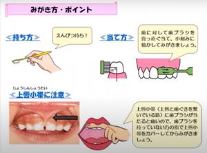 歯のお手入れ　歯ブラシ持ち方