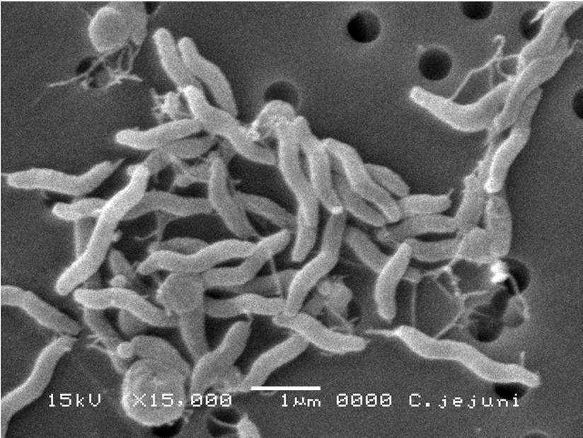 カンピロバクターの電子顕微鏡写真