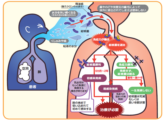 感染と発病のちがい