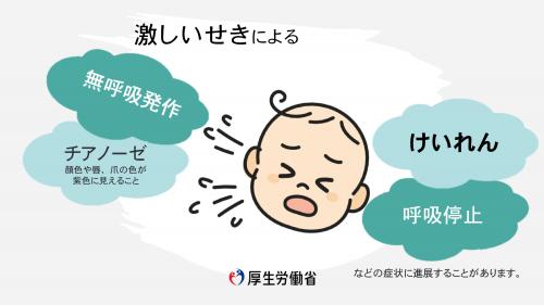 百日咳　乳児の症状