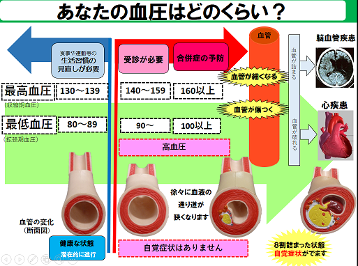 あなたの血圧はどのくらい？